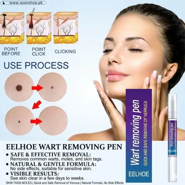 Wart Removing Pen