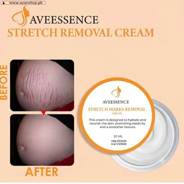 Aveessence Stretch Marks Removal Cream image 2