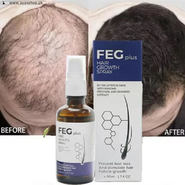 Feg Hair Growth Spray Price In Pakistan image 3